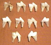 Picture of this lot Coyote Teeth, Canines, Molars